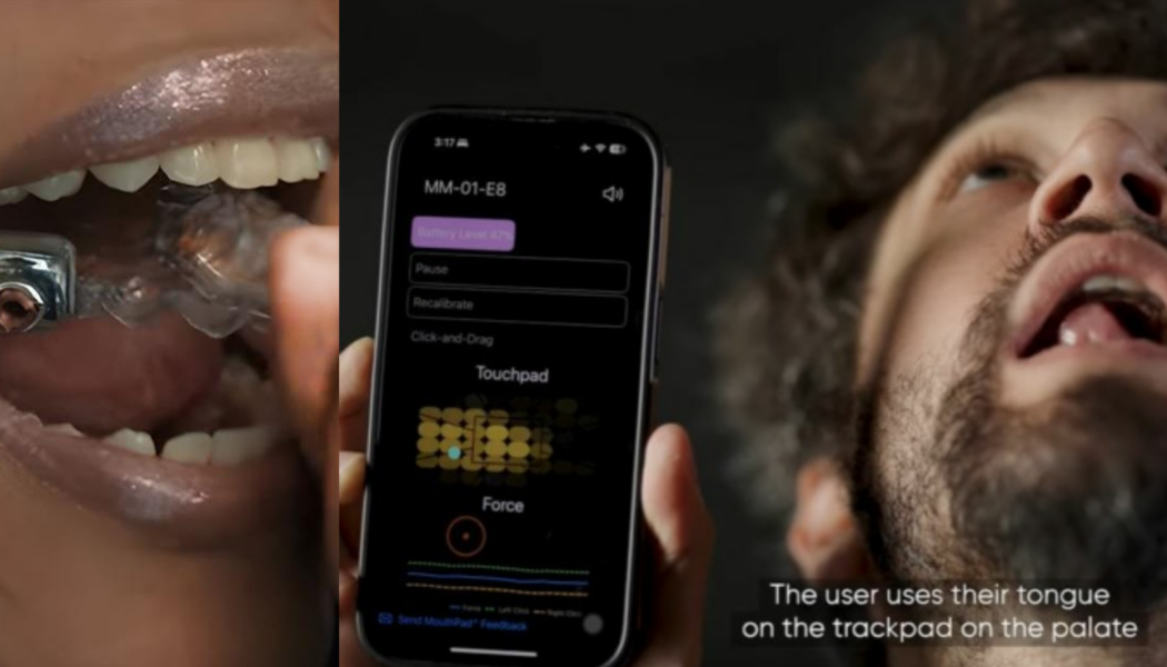 Mouthpad^ 🛏️🔧2.0, or more?